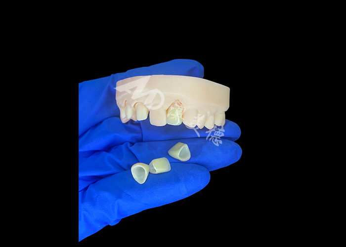Natural and Comfortable Fit Zirconia Porcelain Crown China Dental Lab Customizable Shade