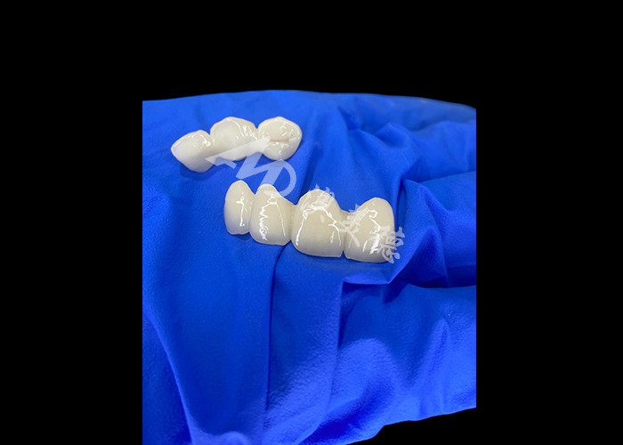 Wieland Zenostar Ceramic Crown Bridge High Precision for Durable and Natural Looking Restorations
