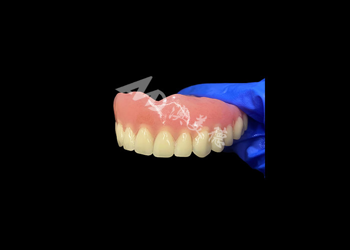 Full Arch Acrylic Denture An Affordable Solution for International Removable Denture Needs