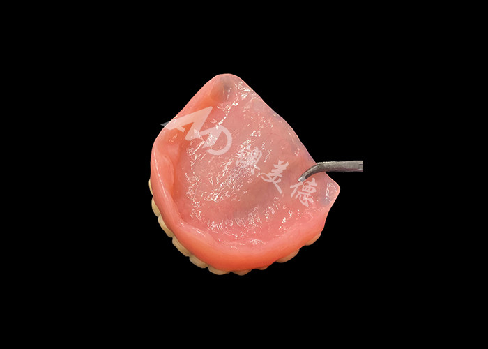 Full Arch Acrylic Denture An Affordable Solution for International Removable Denture Needs