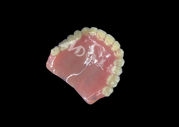 Full Arch Acrylic Denture An Affordable Solution for International Removable Denture Needs