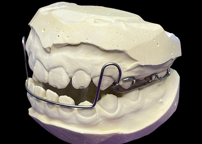 Guidewire Orthodontic Appliance for Precise Teeth Movement and Alignment
