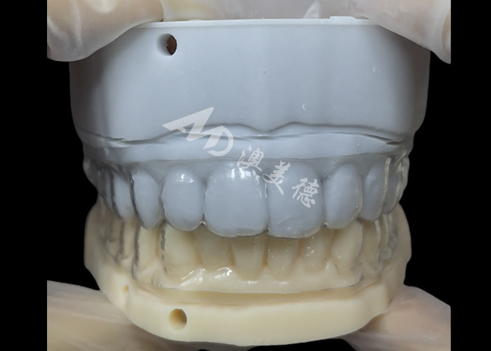 Orthodontic retainer Essix Retainer Simple And Versatile Correction