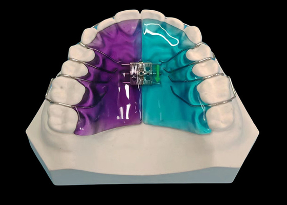 Good price Removable Expander for Effective Orthodontic Treatment and Smile Enhancement online