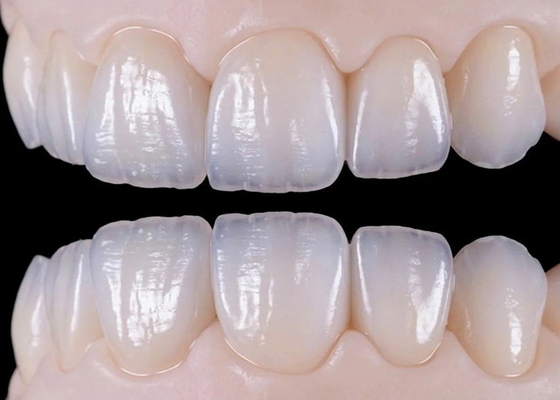 Good price Natural Wear Resistant Ceramic Dental Crown Bridge For Lifelike Restoration online