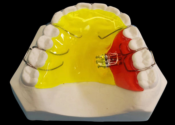 Good price Three Direction Removable Orthodontic Appliances For Customer Requirements At Competitive Prices online
