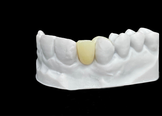 Good price Chipping Resistance Zirconia dental Crown With Exceptional Strength And Translucency online