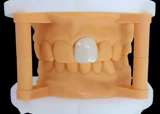 Good price Translucency Zirconia Dental Crown with Aesthetic Performance from China Dental Lab online