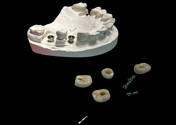 Good price Polished Surface Dental Implant Screw Retained Crown For Tooth Replacement online