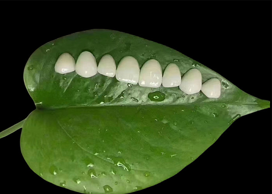 Good price Minimal Preparation Porcelain EMAX Veneer For Cosmetic Dental Treatment online
