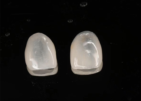 Good price Aesthetic Restoration Emax Ceramic Veneers Translucency with Polished Surface online