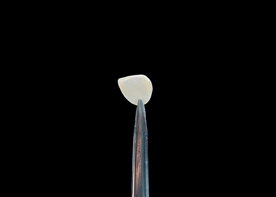 Good price Precision 0.2-0.5mm EMAX Cosmetic Teeth Veneers Natural Looking Chemical Bonding online