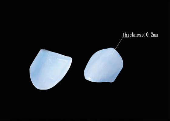 Good price Cosmetic Dentistry EMAX Porcelain Veneers for Beautiful Dental Restorations online