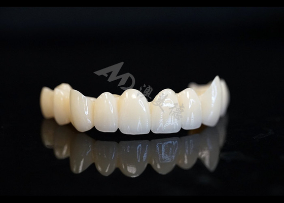 Good price Precision Made Solid Zirconia Crown For Perfect Dental Fit And Comfort online
