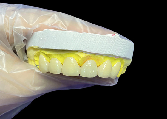 Good price Cosmetic Vita Classical Shade Ceramic Crowns and Bridges with Precise Fit Natural Look and Customizable Options online