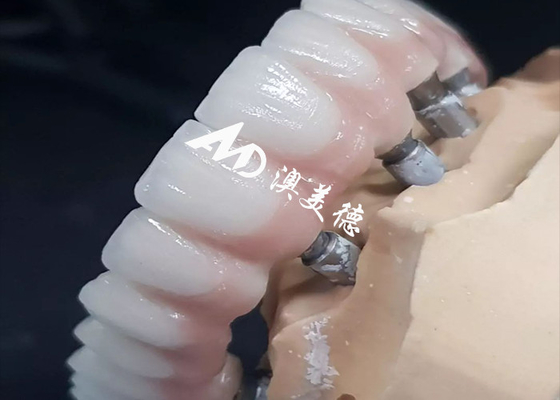 Good price Exclusive High Performance Dental Implant Crown Bridge Various Sizes Available online