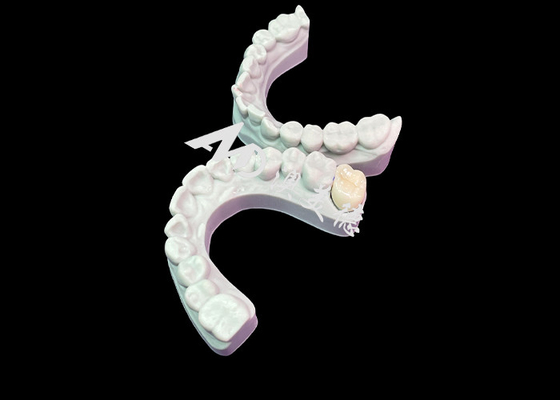 Good price Precise Fit Zirconia Dental Crown Aesthetic Natural Colour Excellent Biocompatibility online