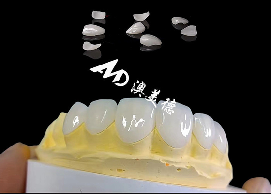 Good price Translucencys IPS Emax Veneers , Minimal Preparation Emax Dental Veneers online