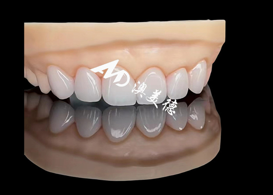 Good price Porcelain EMAX Veneer High Precision Esthetic Restorations with Superior Durability online