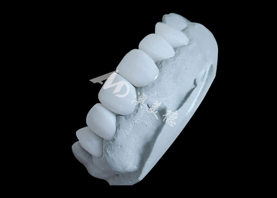 Good price Zirconia Dental Crown Delivering Unbeatable Strength And Natural Smoothness,And Natural Translucency online