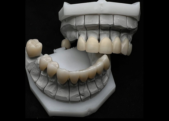 Good price Resistance Chipping Dental Zirconia Crown For Single Or Multiple Teeth online