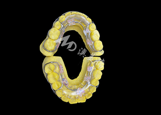 Good price Beagle Retainer for Effective Smile Retention and Long-Lasting Alignment online