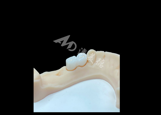 Good price Highly-rated Solid Zirconia Crown For Satisfying Dental Restorations online