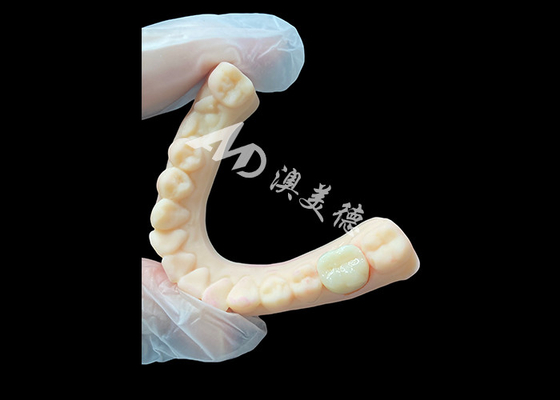 Good price High Strength Ceramic Zirconia Posterior Dental Crown Superior Aesthetic and Durability online