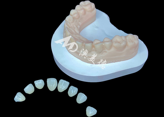 Good price IPS E.max Veneer Premium Aesthetic Solution For Stunning Smile Transformations online
