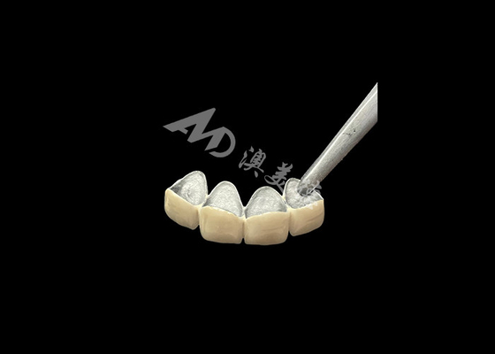 Good price Porcelain Fused to Metal Crown with Enhanced Corrosion Resistance online