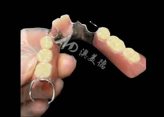 Good price Titantium Cast Partial Dentures With Clasps Rests Along With Teeth Set Up online
