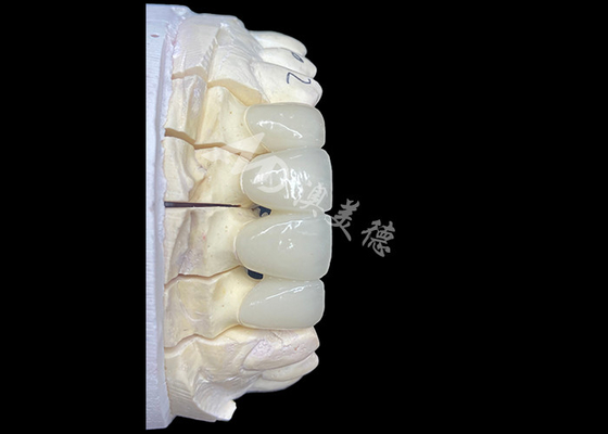 Good price Natural-Looking Zirconia Ceramic Crown Bridge Provides Precision And Aesthetics Combined online