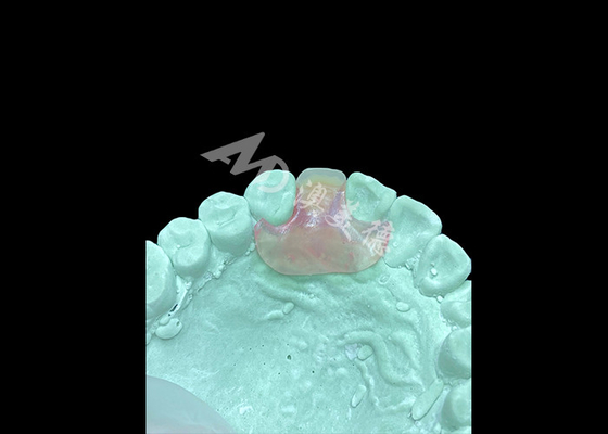 Good price Lightweight and Comfortable Nesbit Flexible Denture for Single Tooth Replacement online