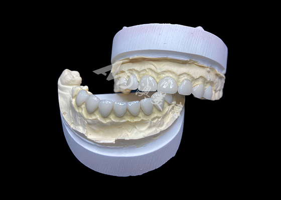 Good price Customization Ultra Thin Glass Ceramic Veneers High Translucency for a Natural Smile online