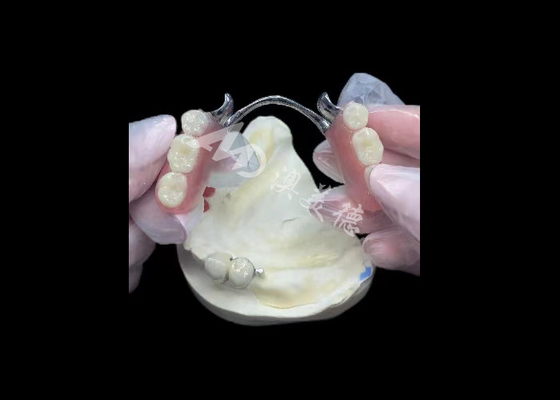 Good price Durable Porcelain Fused To Metal Dental Crown PFM Crown For Restoration online