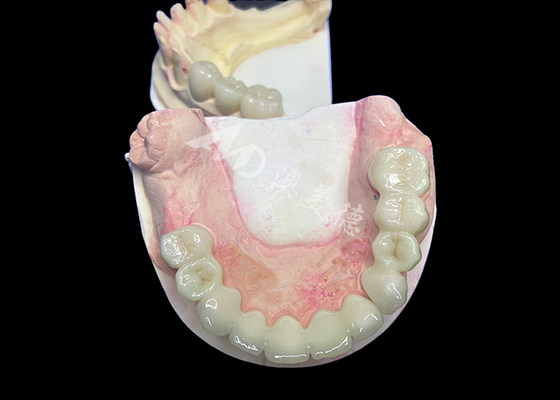 Good price Natural Looking Lava Zirconia Crown With Unrivaled Durability Excellent Biocompatibility online