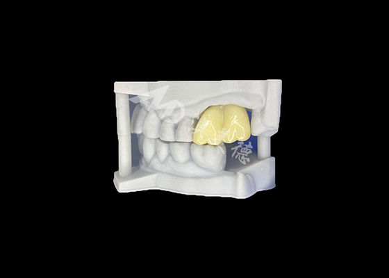 Good price Solid Zirconia Dental Crown Long-lasting Durability Guaranteed Molar From China Dental Lab online
