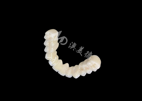 Good price Long-lasting Bonding PFM Dental Crown Bridge With Excellent Biocompatibility Secure Bonding online