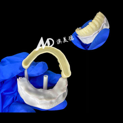 Good price PMMA Provisional Implant Bridge with Hollow Inside for Stability and Natural Healing, High-precision CAD/CAM Fabrication, Biocompatible PMMA Material online