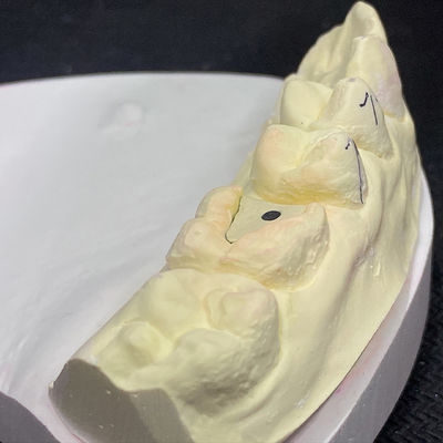 Good price Reinforce Your Restoration with Lock Pink Post Core Technology online