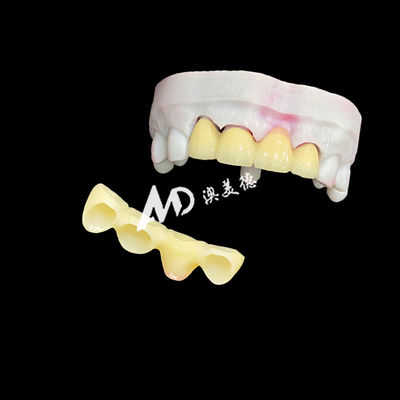 Good price Premium Ceramic Crowns and Bridges for High-Strength, Natural Aesthetics and Long-Lasting Clinical Performance online
