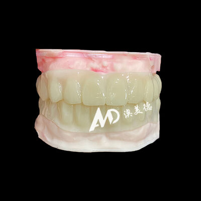 Good price PMMA Hollow Temporary Bridges for Implant Provisional Cases online