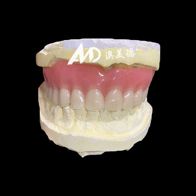 Good price Removable Denture Full Acrylic Denture Suitable for Various Dental Applications Offering Durable and Comfortable Solution online