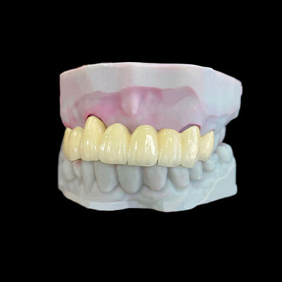 Good price Porcelain Fused to Metal (PFM) Crown with Co-Cr Framework online