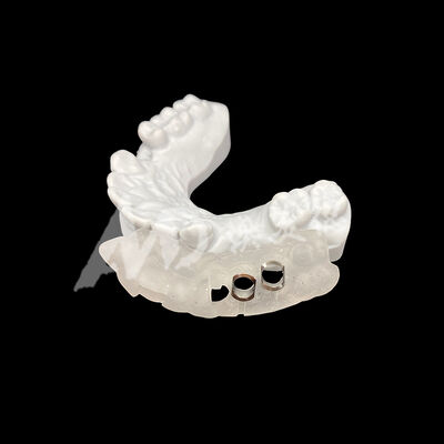 Good price Precise Fit 3D Printed Surgical Implant Guide with High Resistance to Discoloration Using CAD/CAM Milling Technology online