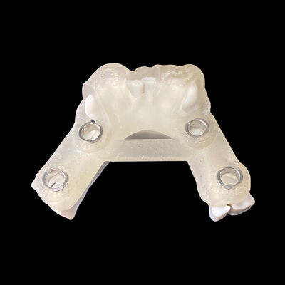 Good price Digital Implant Surgical Guide with Implant Planning Report online