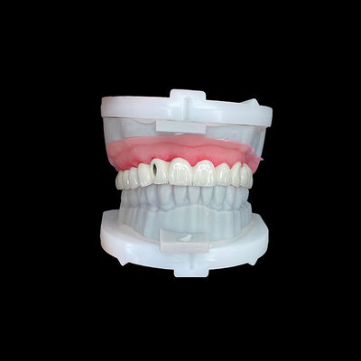 Good price Full Arch Implant Bridge with High-Strength CoCr Metal Framework and Premium Porcelain Layering for Precision Fit online