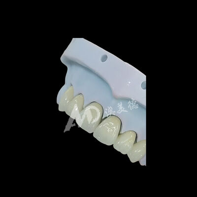Good price Full Contour Monolithic Zirconia Dental Crown online